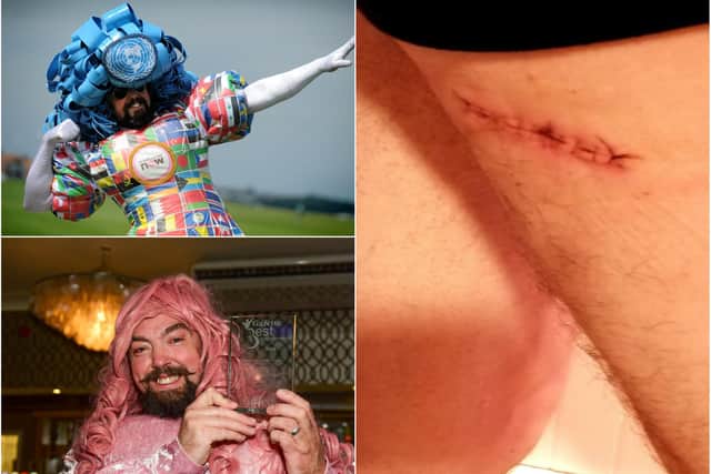 Colin Burgin-Plews who has fought back from an operation to remove skin cancer.
