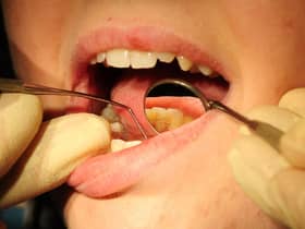 Child dental care fears.