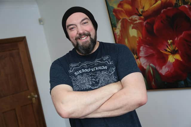 Fundraiser Colin Burgin-Plews said he is due to undergo surgery to remove the cancerous cells following his diagnosis.