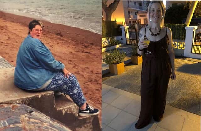 Before and after picture of slimmer Sue Thompson