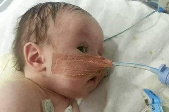 Baby Jack in hospital.