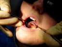 Fears over South Tyneside dental care