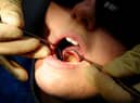 Fears over South Tyneside dental care