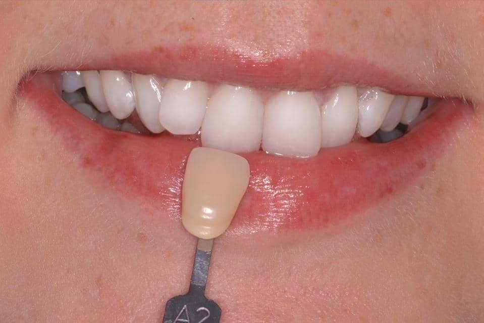 Win a £249 smile.