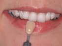 Win a £249 smile.