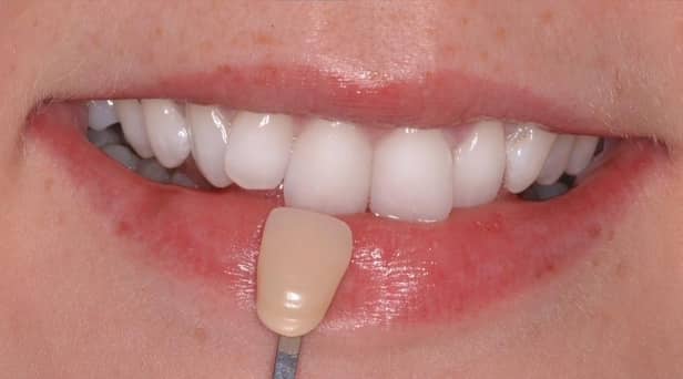 Win a £249 smile.