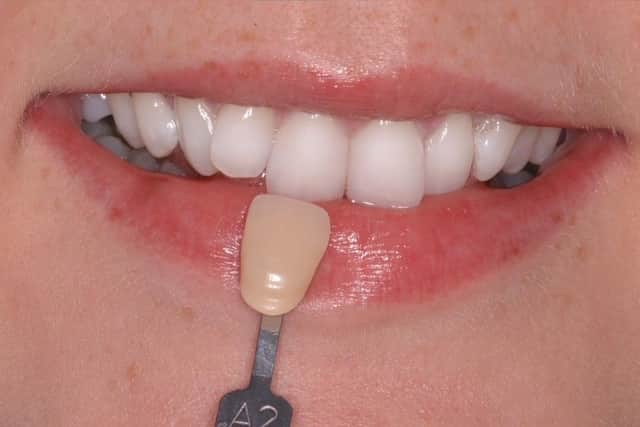 Win a £249 smile.