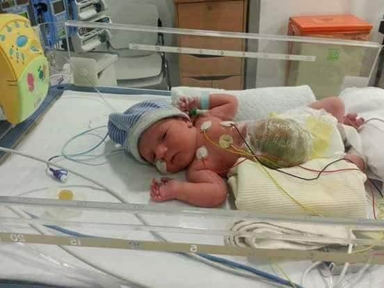 Jack in hospital when he was a baby.