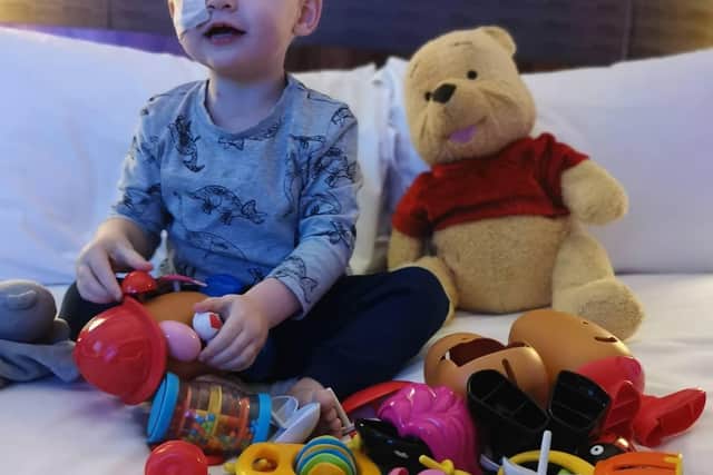Ivor is undergoing chemotherapy, which has caused his hair to fall out