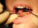 Dental services slump