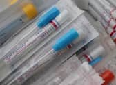 Covid testing kits