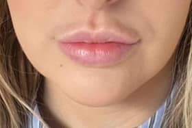Alexandra, who was left with a shadow above her lip.