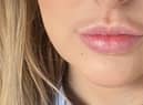 Alexandra, who was left with a shadow above her lip.