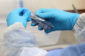 Millions of doses of coronavirus vaccine could be manufactured here in the North East.