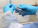 Millions of doses of coronavirus vaccine could be manufactured here in the North East.