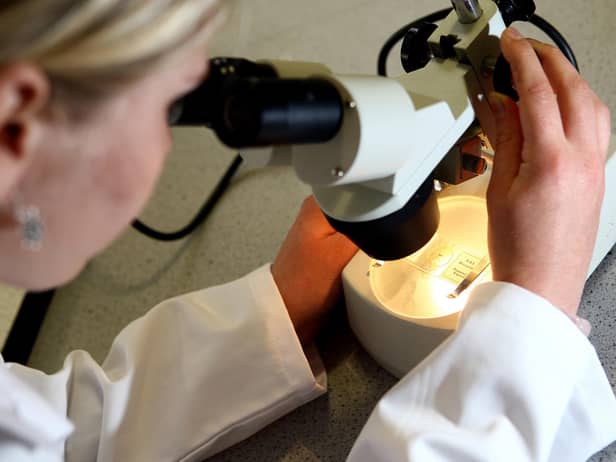 A quarter miss cancer tests.