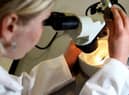 A quarter miss cancer tests.