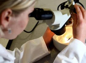 A quarter miss cancer tests.
