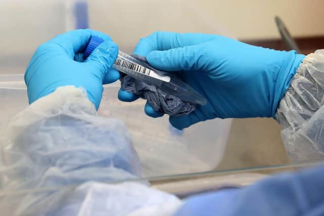 A laboratory technician wearing full PPE (personal protective equipment) cleans a test tube containing a live sample taken from people tested for the novel coronavirus. Photo by Andrew Milligan / POOL / AFP
