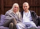 Kai Heslop and girlfriend Nicole Hughes following the surgery. Photo by Steven Lomas.