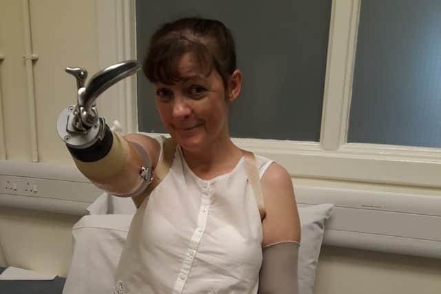 Kathleen Maher is hoping to get bionic arms to give her more independence.