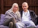 Kai Heslop at home with girlfriend Nicole Hughes following the surgery. Photo by Steven Lomas.
