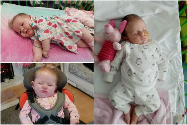 Jasmine Blackburn has been diagnosed with a rare genetic syndrome called Aicardi.