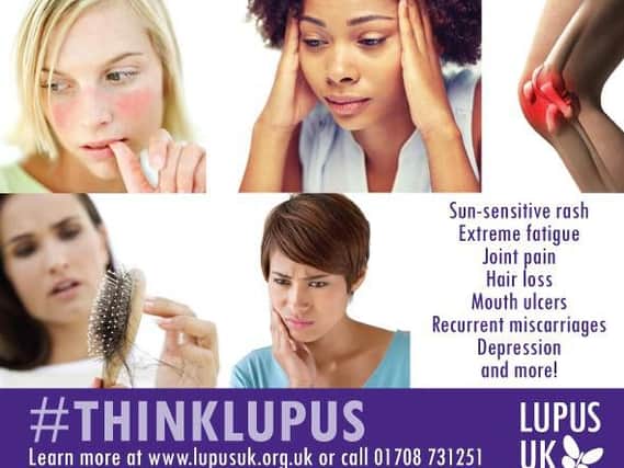October is Lupus Awareness Month.