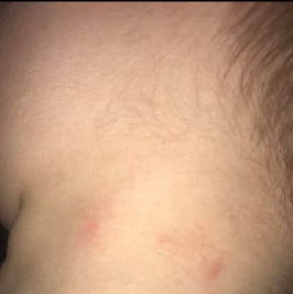 A youngster suffered minor burns to his neck when a firework sent sparks into the crowd