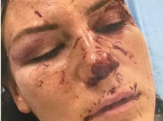 Jade Gallagher pictured after the brutal attack.