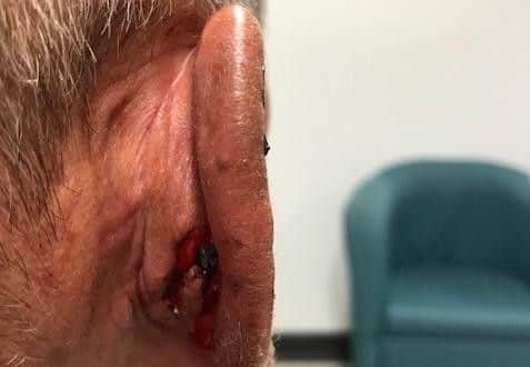 Duncan bit his victim's ear