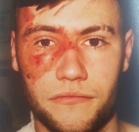 Chris McCormack's face was damaged in the incident as he worked at Dicksons.