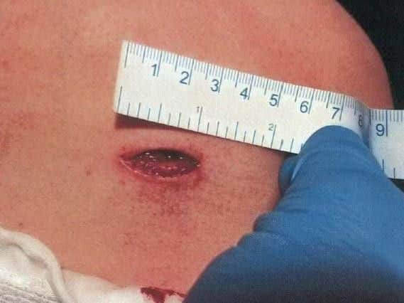 The stab wound in the victim's leg.