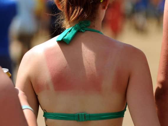 Sunseekers are being urged to take care they don't get burnt this summer, as it can cause lasting damage.