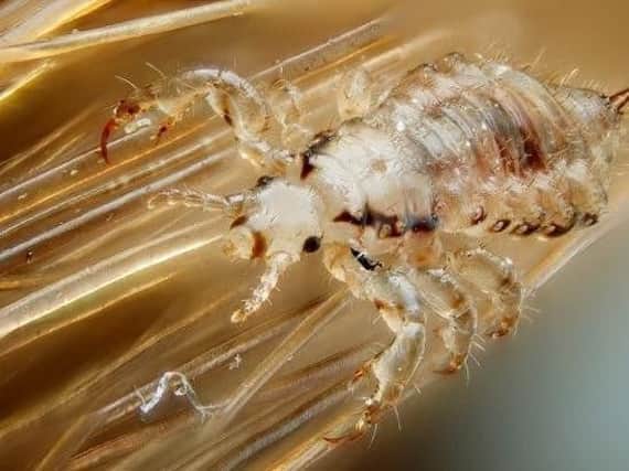 Head-lice are horrible - but can the treatments be harmful to children?
