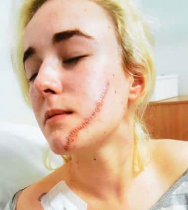 Knife attack victim Katie Charlton